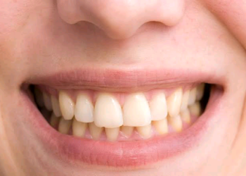 Sirrin Tsaftace Hakora Su Koma Farare Sal (3)