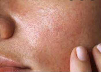 Yadda Za Ki Gane Yanayin Fatarki