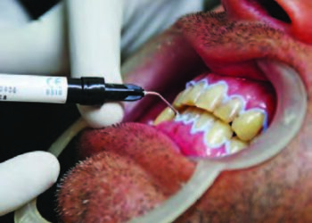 Kula Da Tsaftar Hakori