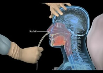 Babu Dalilin Fargaba Ko Tsoro Don Sanya Wa Mara Lafiya Robar Hanci