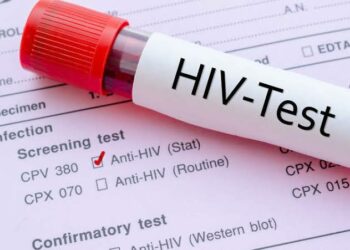 Mutane Miliyan 9 Na Iya Kamuwa Da Cutar HIV Saboda Rashin Tallafi