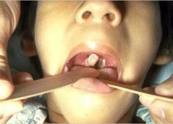 Cutar Mashaƙo Ta Kashe Yara Biyu A Kaduna