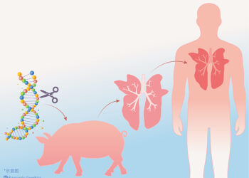 Sin Ta Sanar Da Cimma Nasarar Dashen Huhun Alade A Jikin Bil’Adama