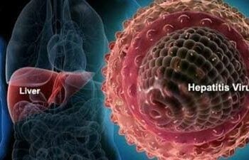 Nijeriya Na Asarar Kusan Naira Tiriliyan 17.9 Duk Shekara Sakamakon Cutar Hanta — Gwamnati