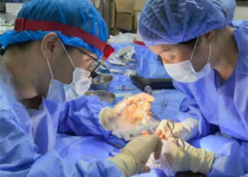 Tawagar Likitocin Sin Dake Saliyo Ta Gudanar Da Tiyatar Dashen Yatsa Irinta Ta Farko