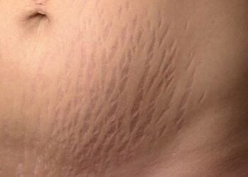 Maganin Nankarwa (4)