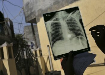Ana Samun Nasara A Yaƙi Da Cutar Fuka Da Kuturta A Jihar Zamfara