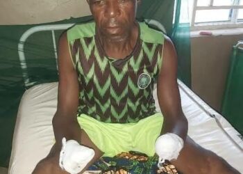 Yadda Ƴan Bindiga Suka Yanke Min Yatsu Biyu — Masunci A Kaduna